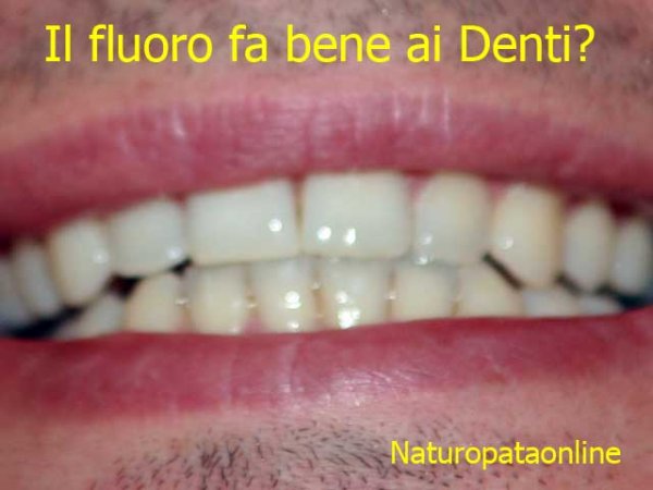 Redazione