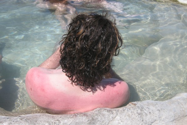 crema_per_pelle_secca_e_arrossata
